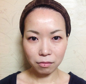 after