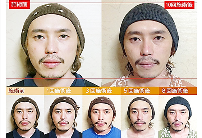 小顔整体コルギとは？