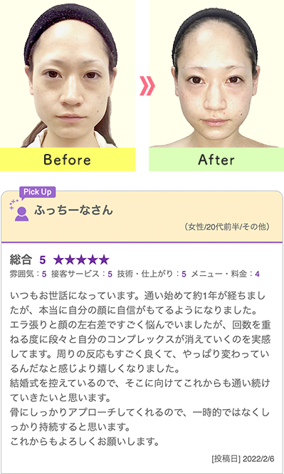 比較写真とお客様の声