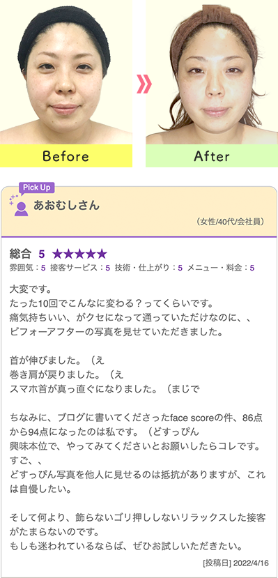 比較写真とお客様の声