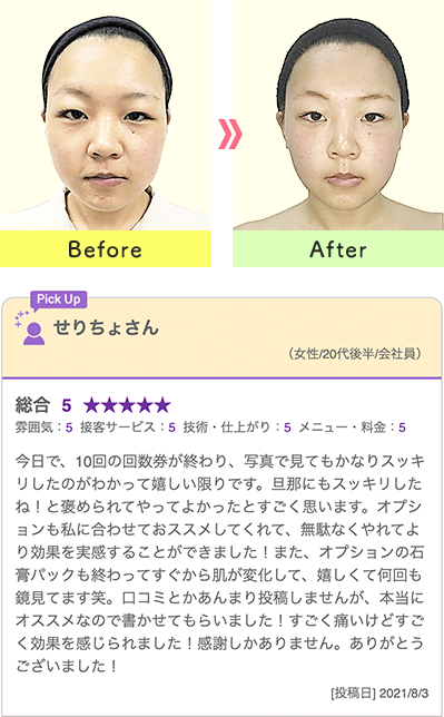 比較写真とお客様の声
