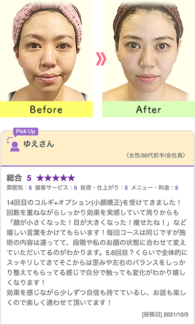 比較写真とお客様の声