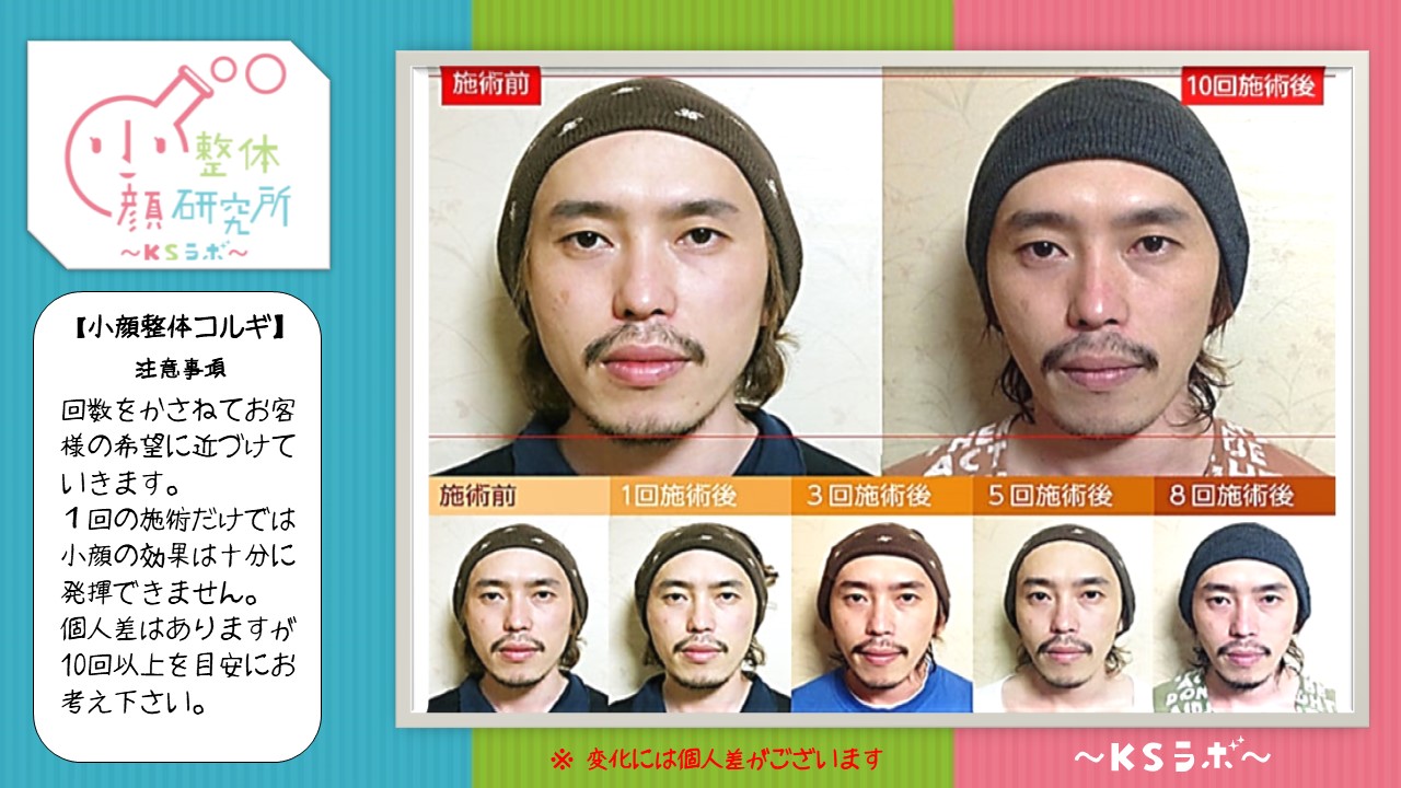 ビフォーアフター