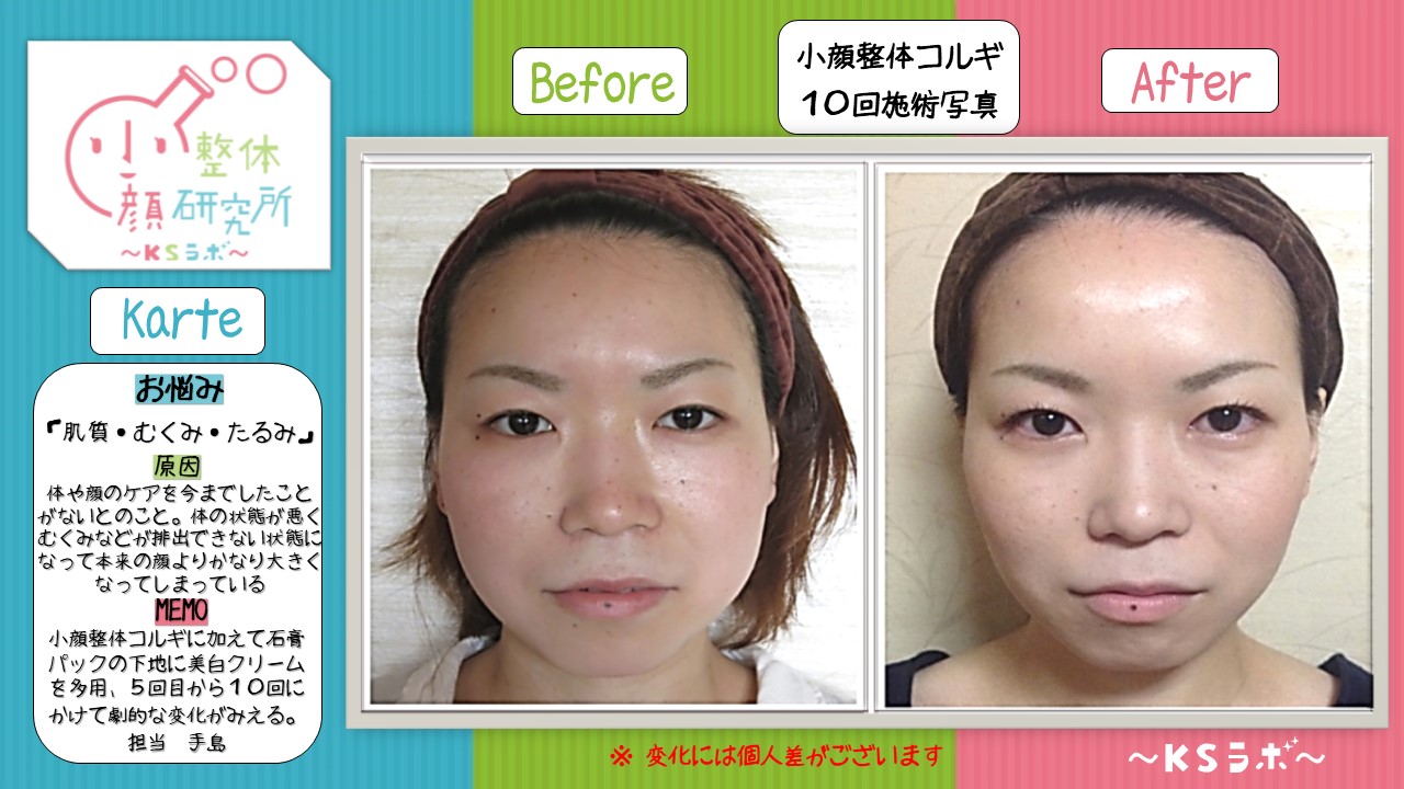ビフォーアフター