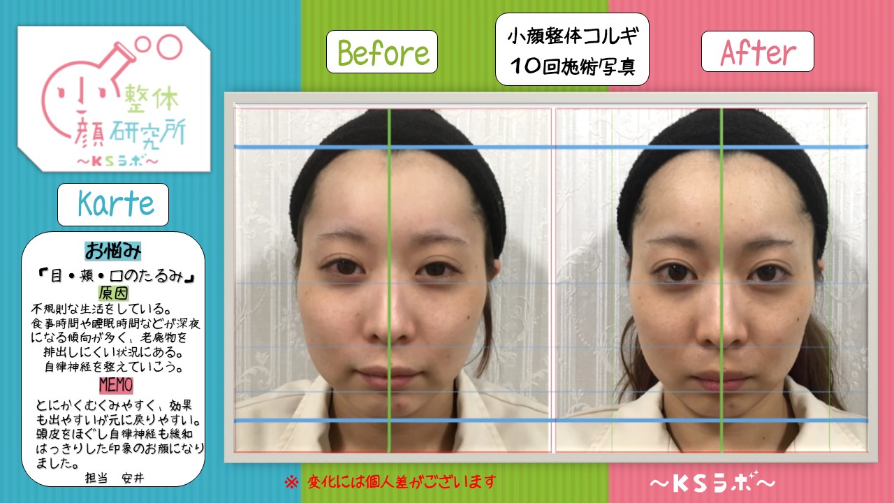 ビフォーアフター