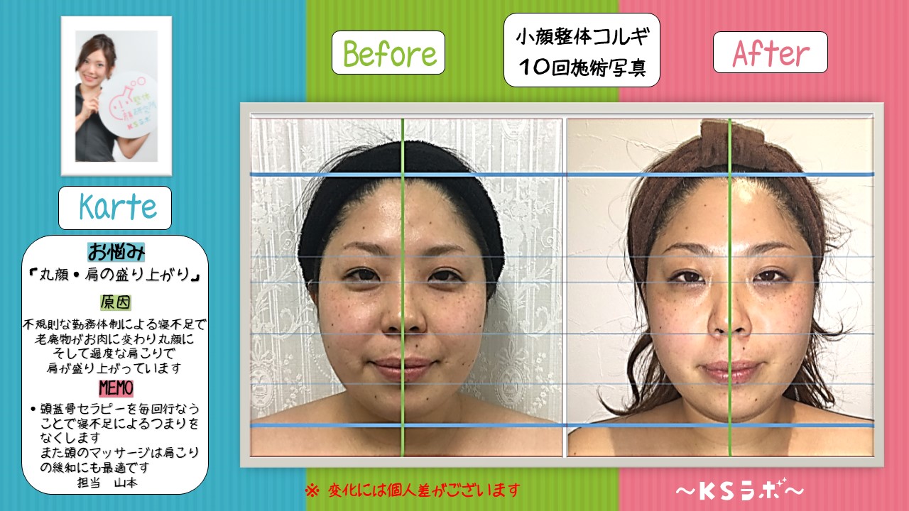 ビフォーアフター