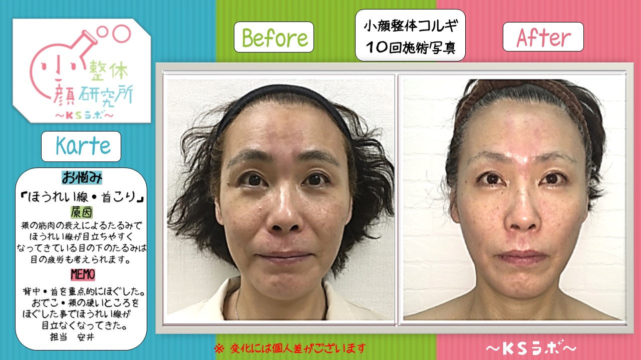 ビフォーアフター