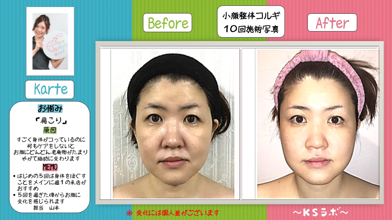 ビフォーアフター