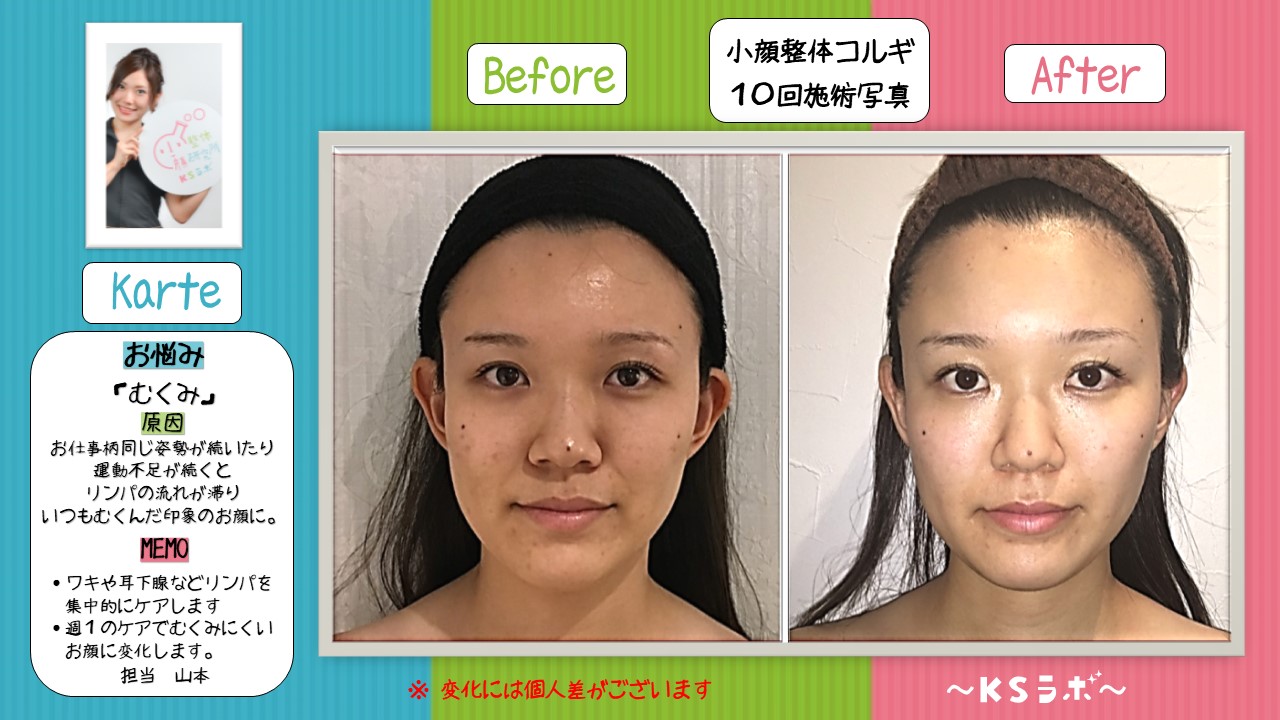 ビフォーアフター