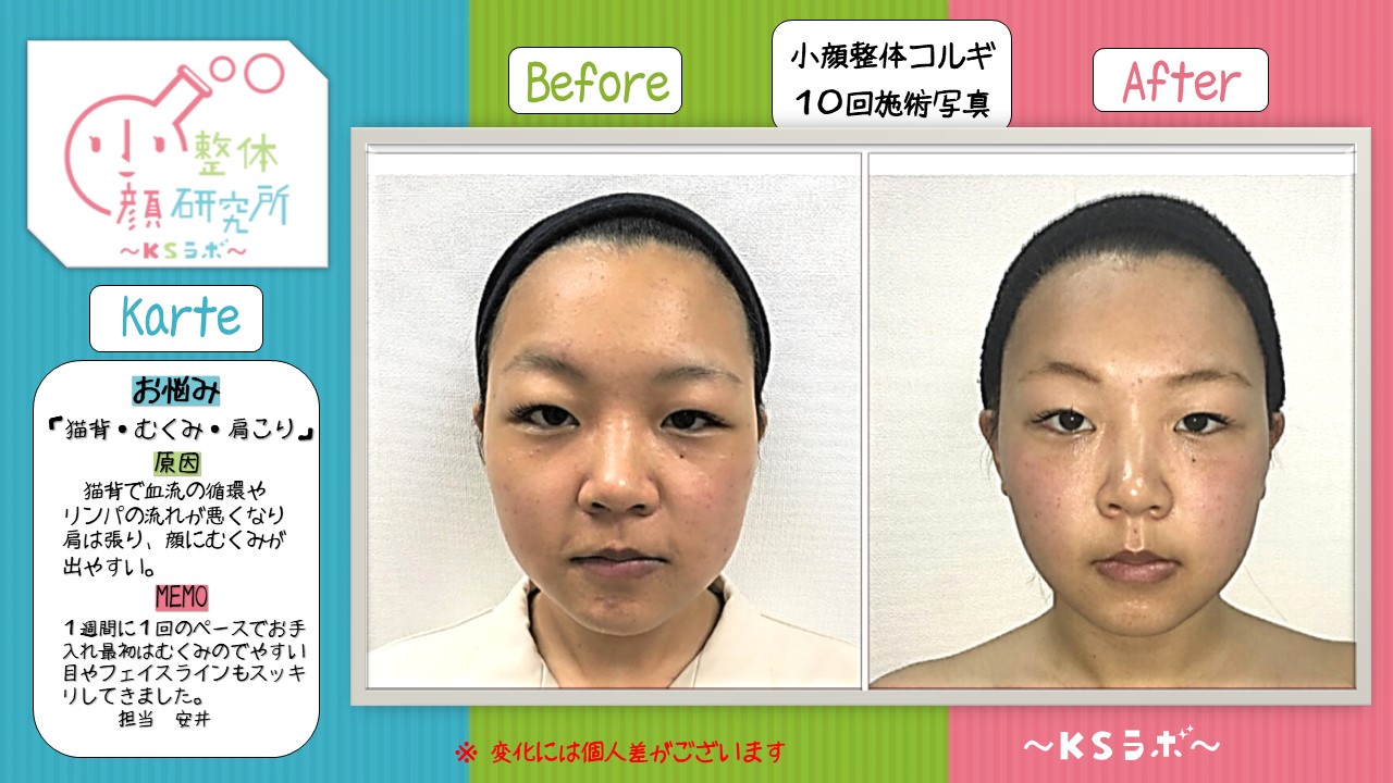 ビフォーアフター
