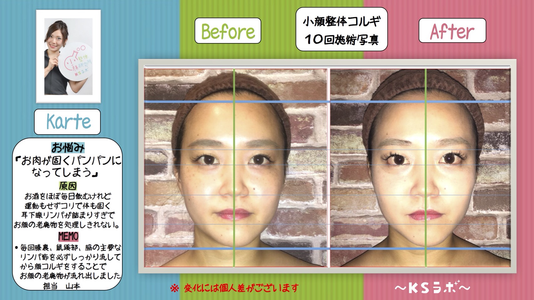 ビフォーアフター