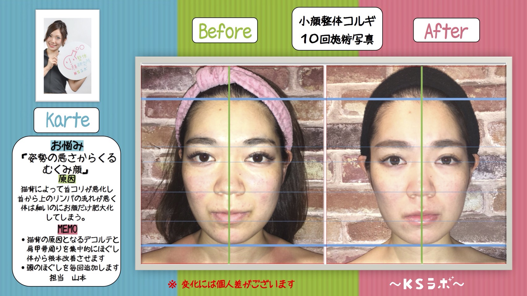 ビフォーアフター