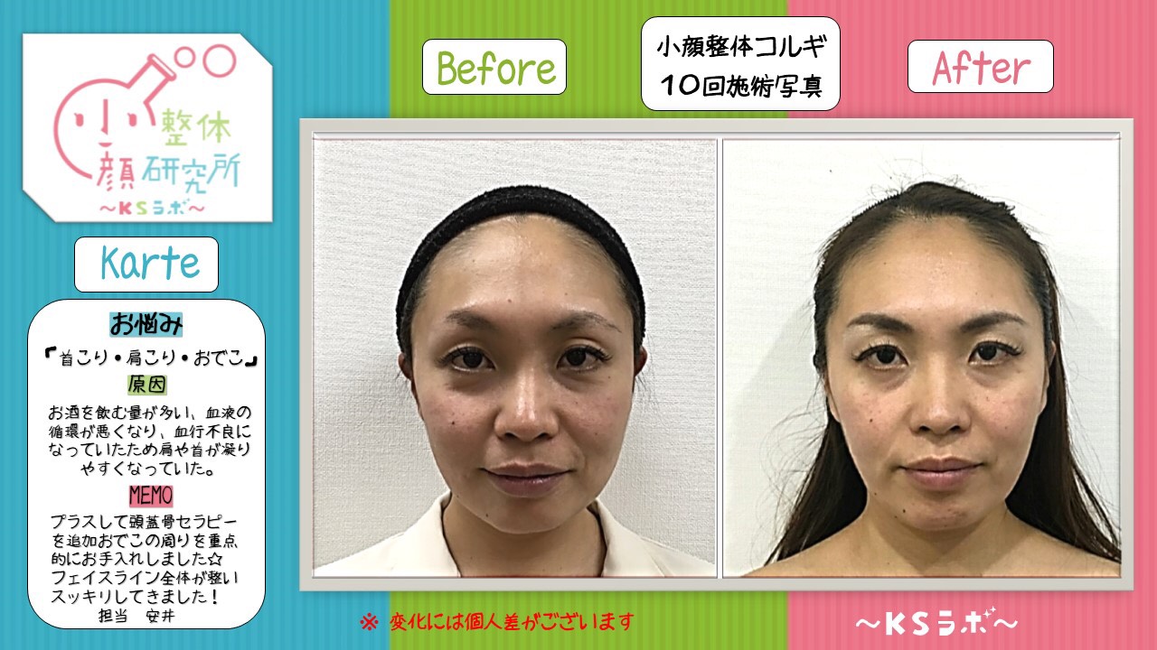 ビフォーアフター
