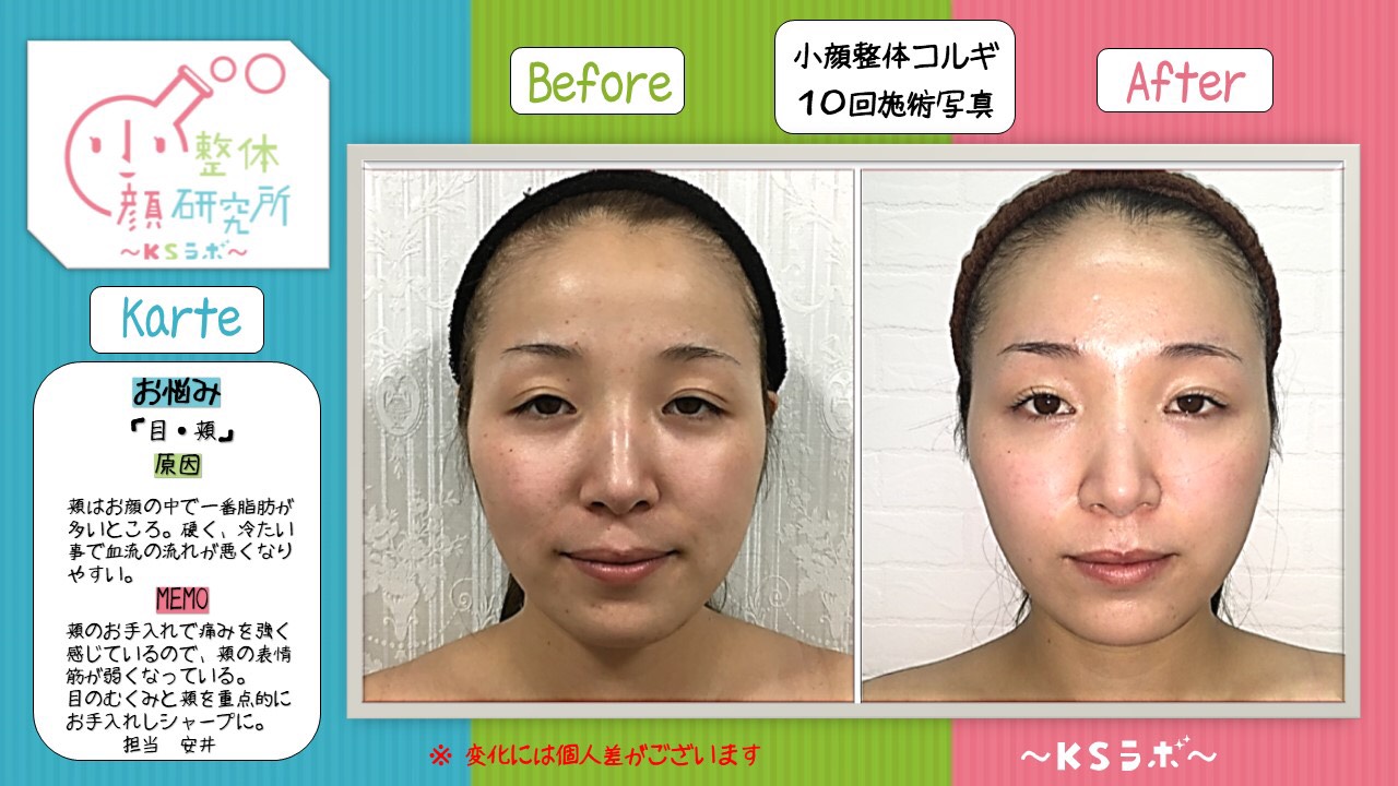 ビフォーアフター