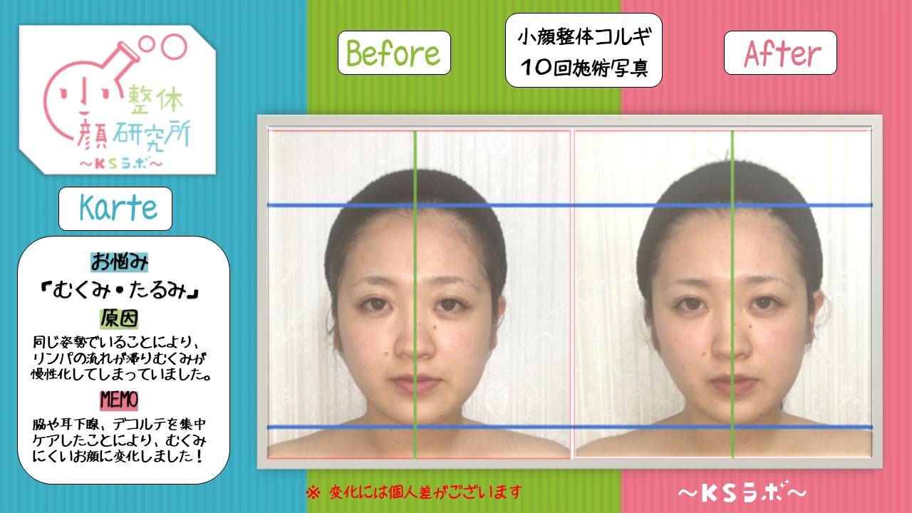 ビフォーアフター