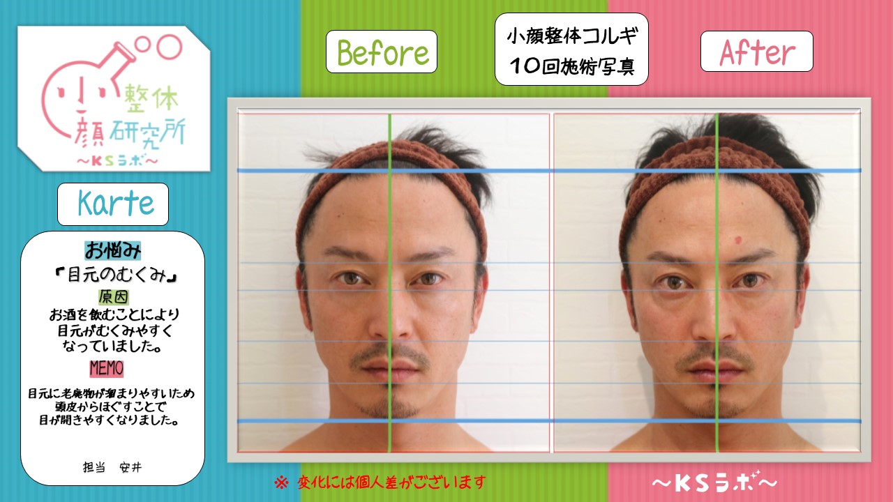 ビフォーアフター