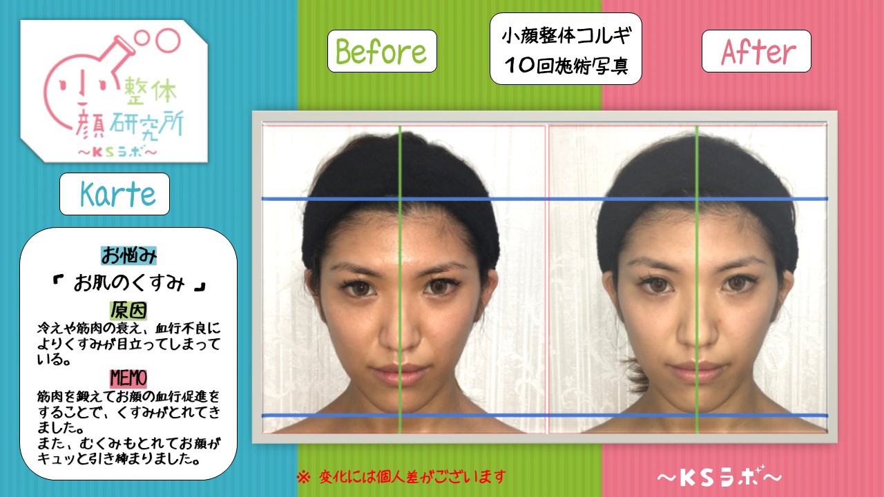 ビフォーアフター