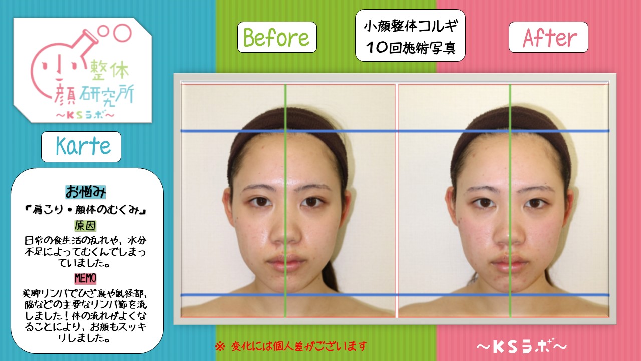 ビフォーアフター