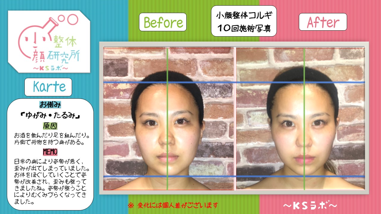 ビフォーアフター
