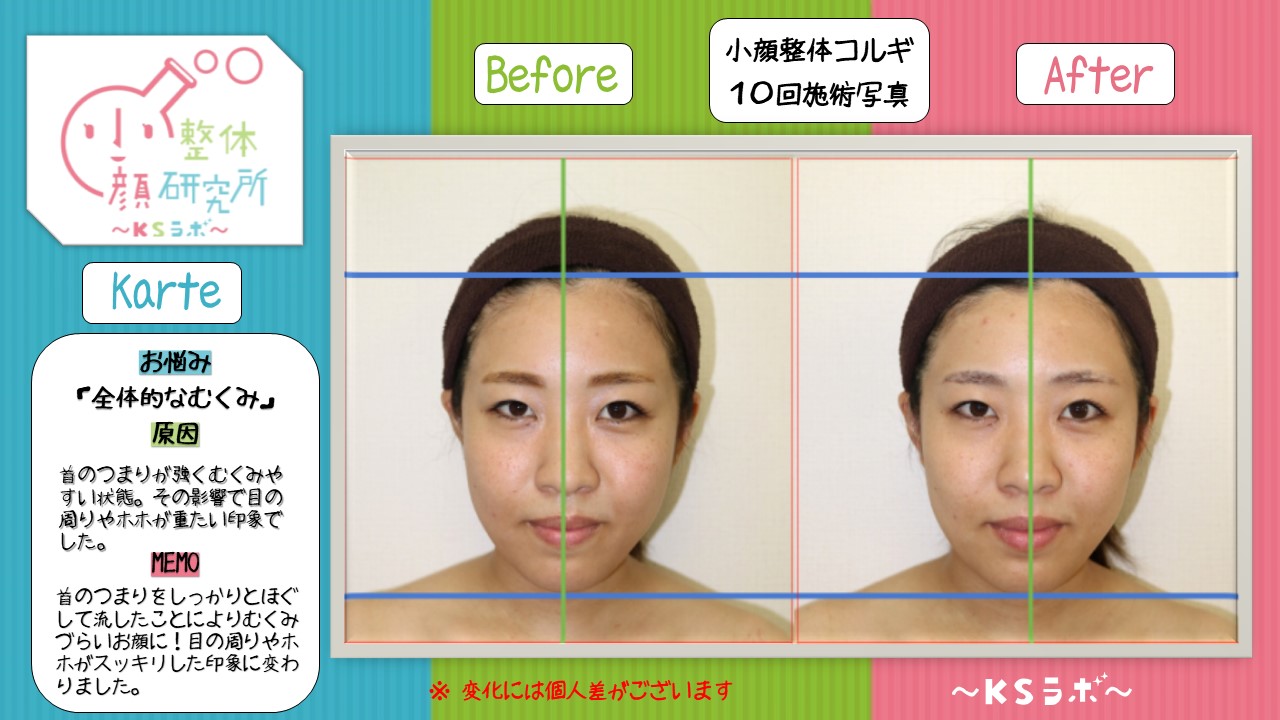 ビフォーアフター