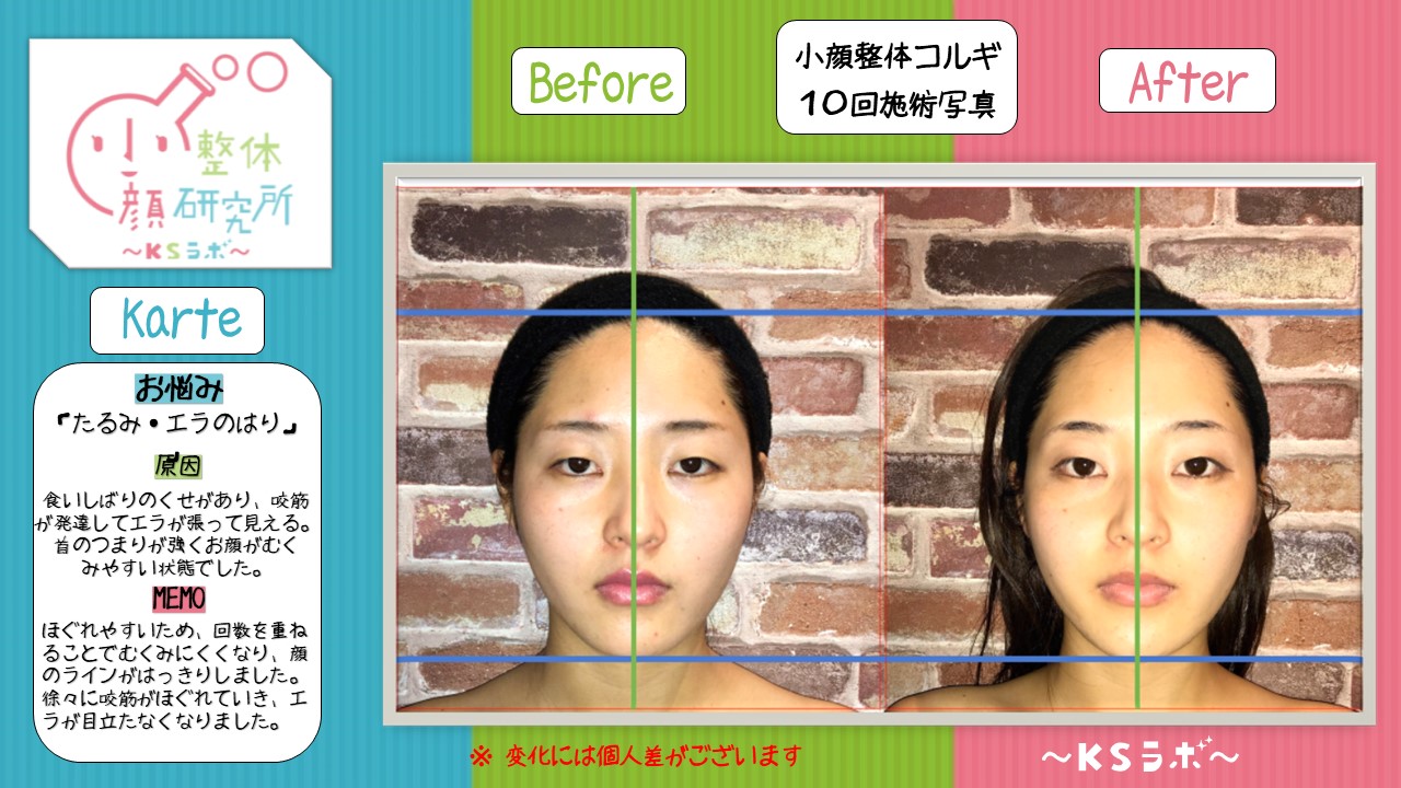 ビフォーアフター