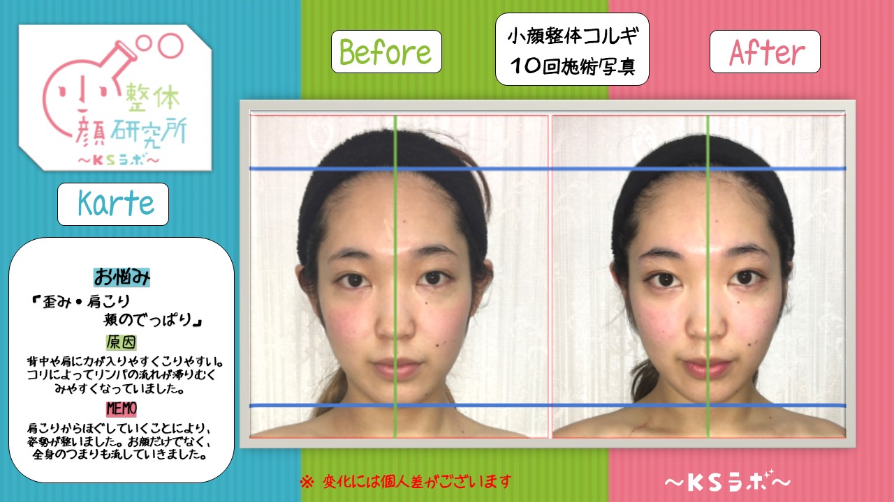 ビフォーアフター