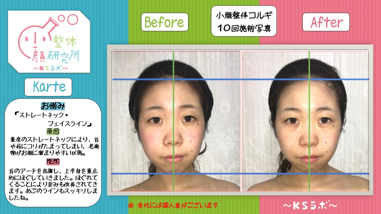ビフォーアフター