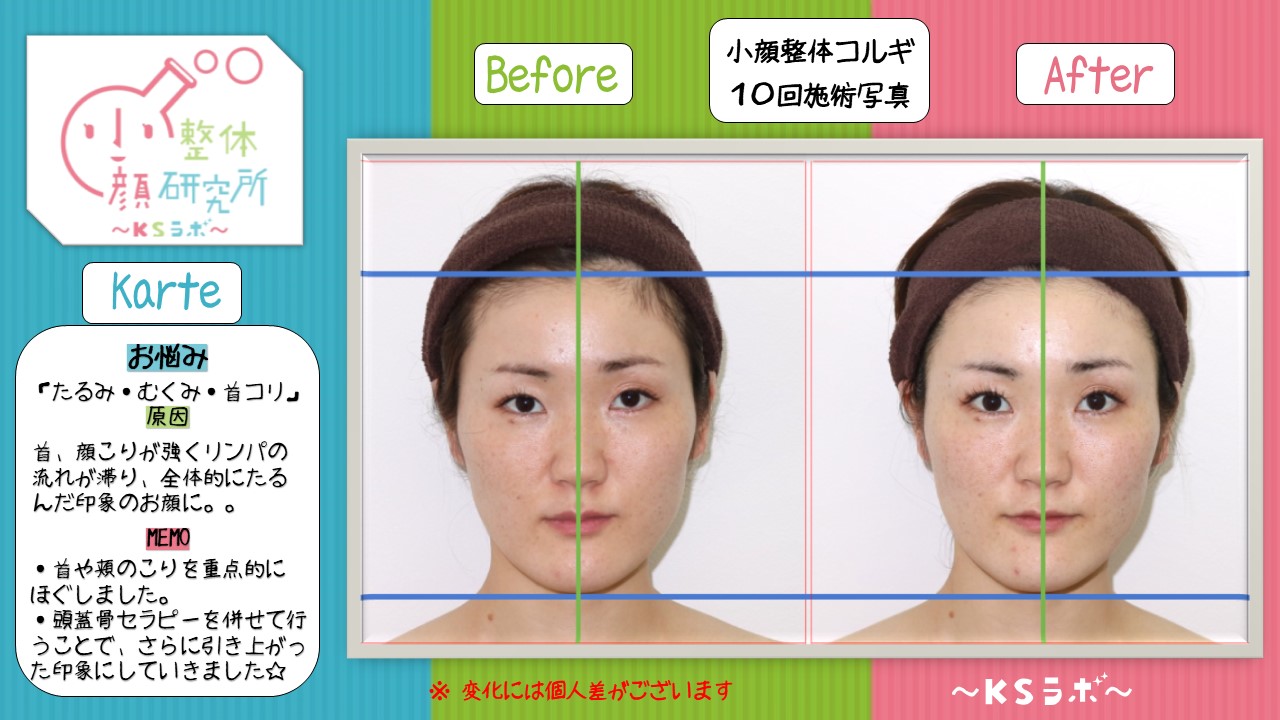 ビフォーアフター