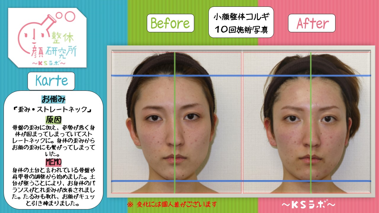 ビフォーアフター