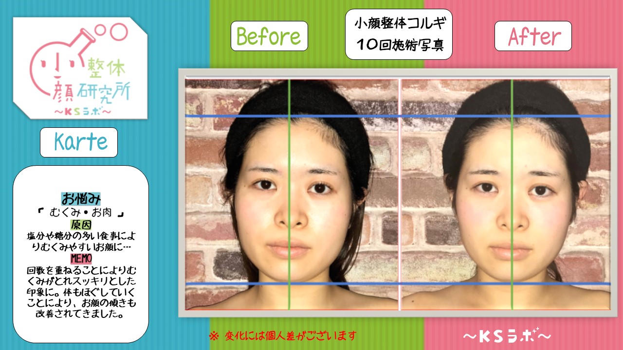 ビフォーアフター