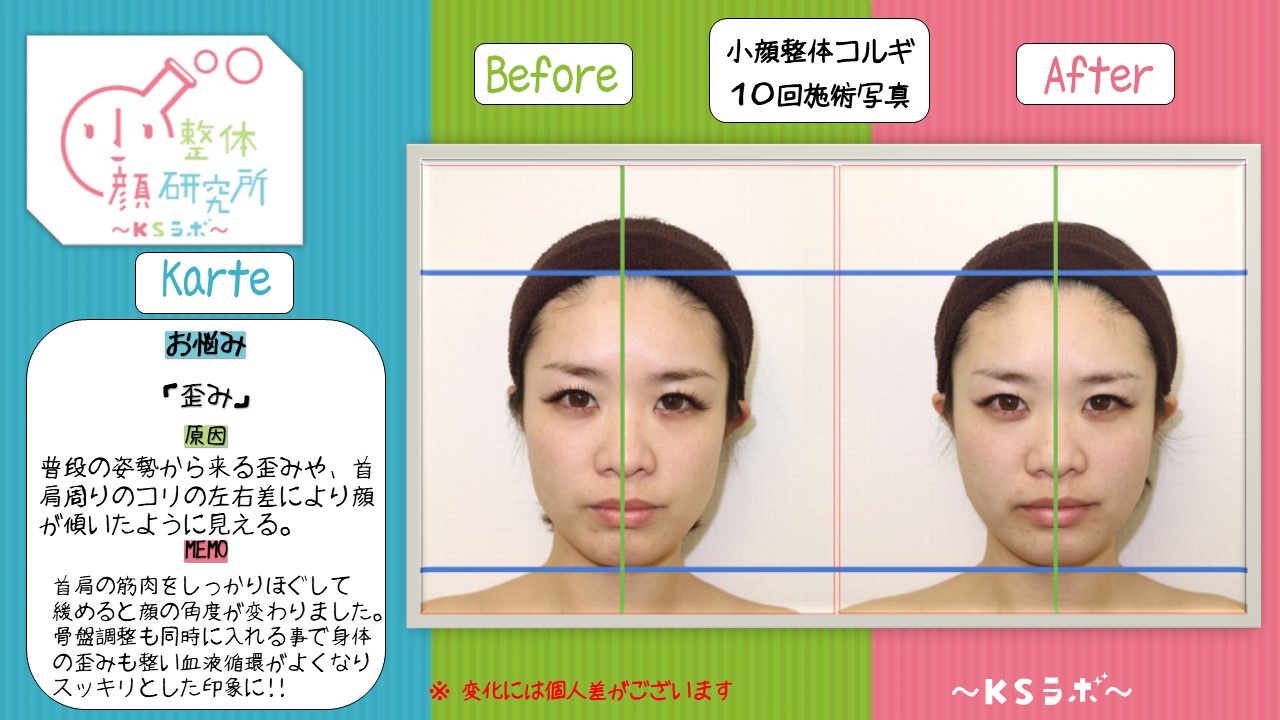ビフォーアフター