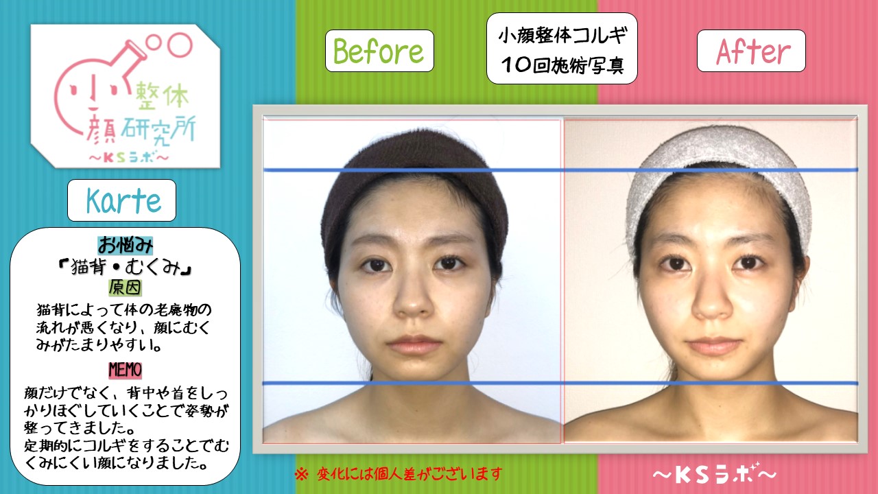 ビフォーアフター